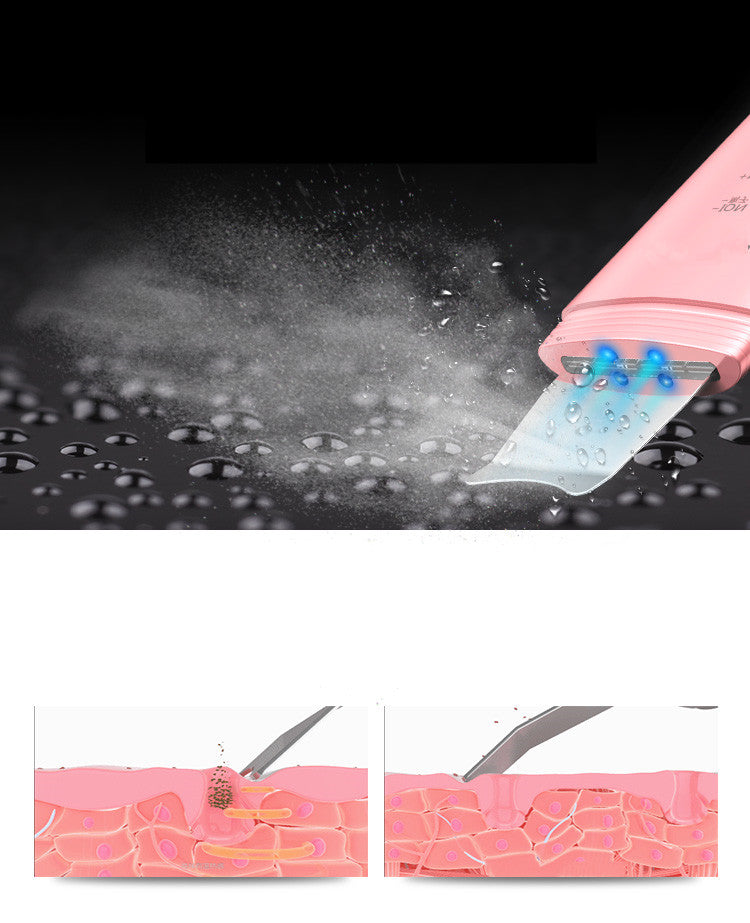 High-Quality-Glowsavy-Ultrasonic-Skin-Scrubber