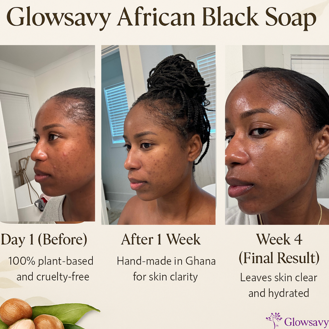 From Breakouts to Brilliance: One Glow at a Time